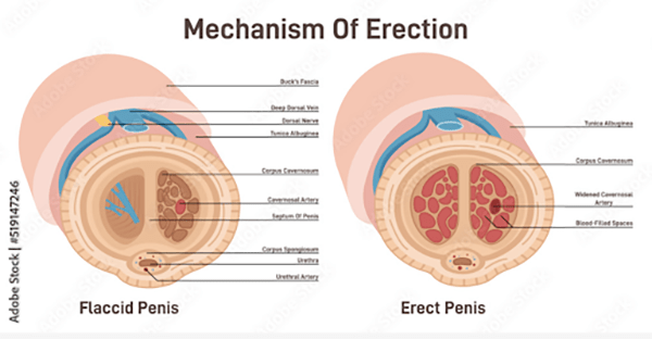 Erection Mechanism